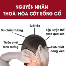 BẤM HUYỆT TRỊ LIỆU THOÁI HÓA ĐỐT SỐNG CỔ